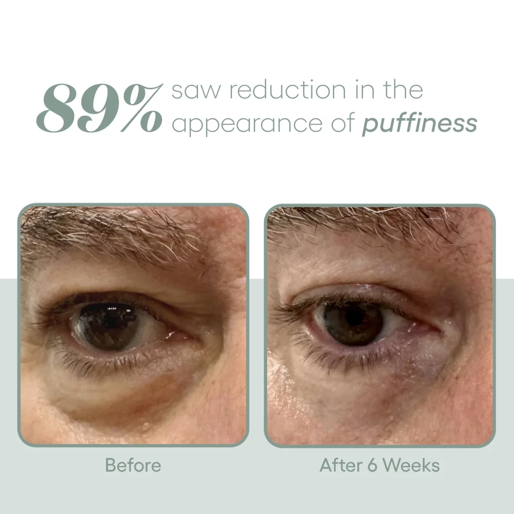 EYE Serum - Image 7