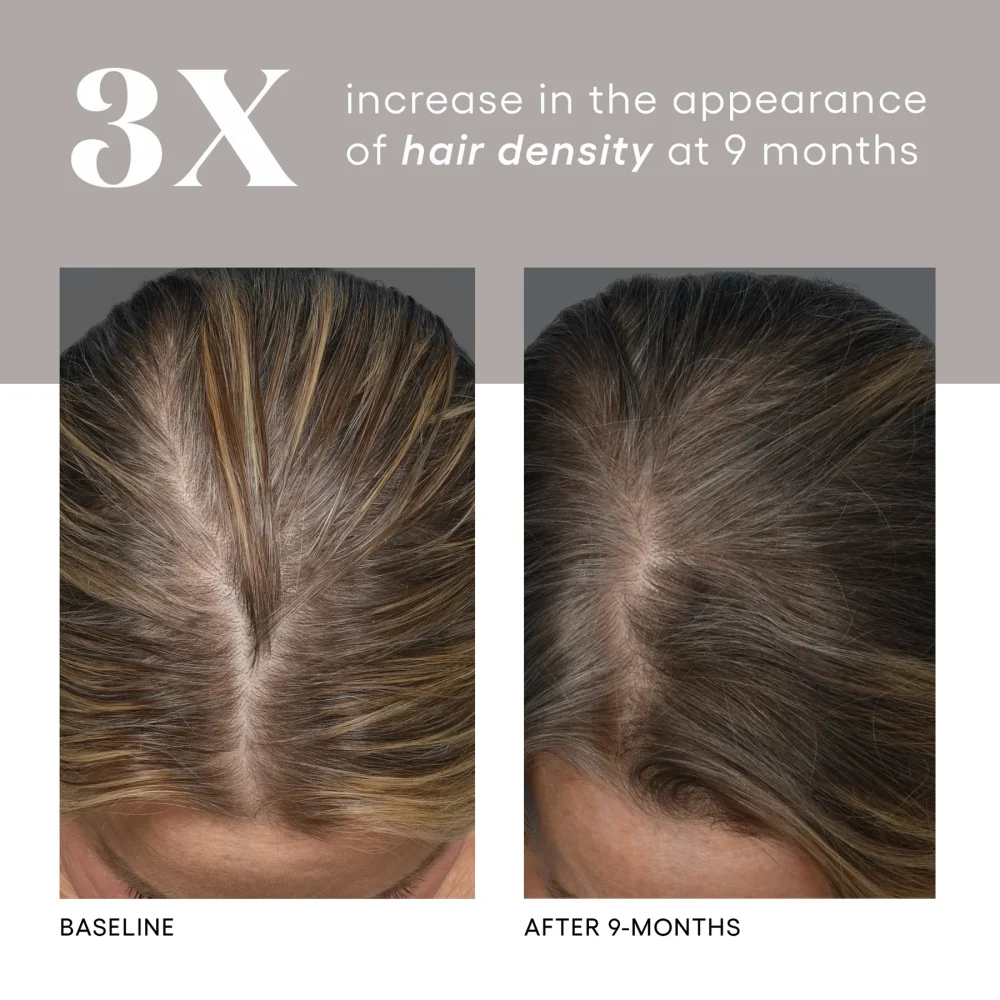 HAIR Serum - Image 8