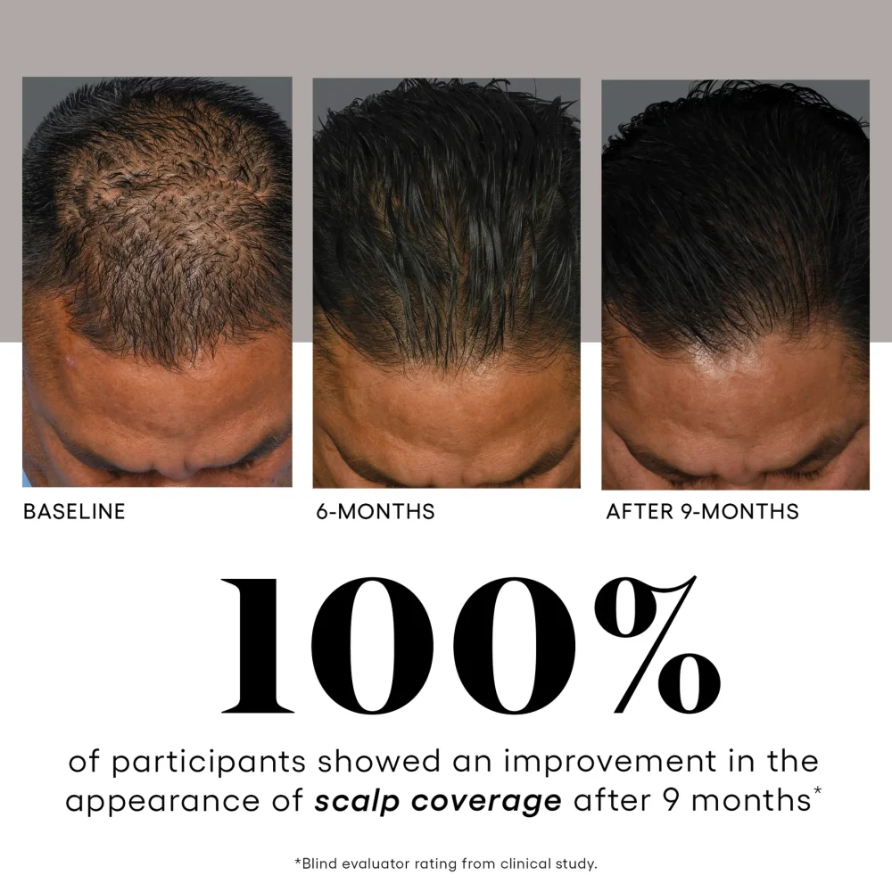 HAIR Serum - Image 9