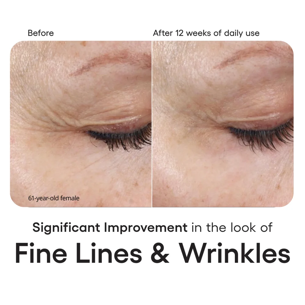 INTENSE Serum Refill - Image 5