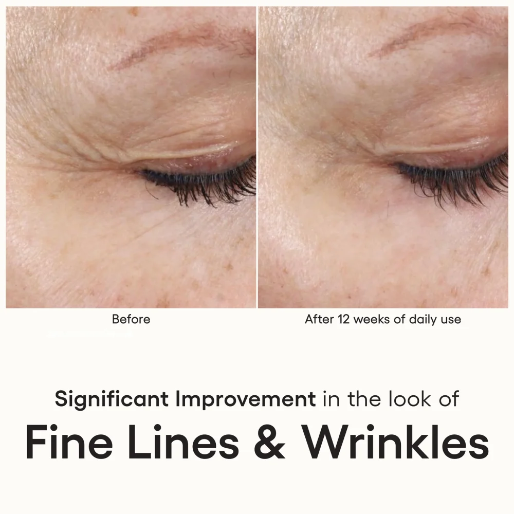 INTENSE Serum - Image 6
