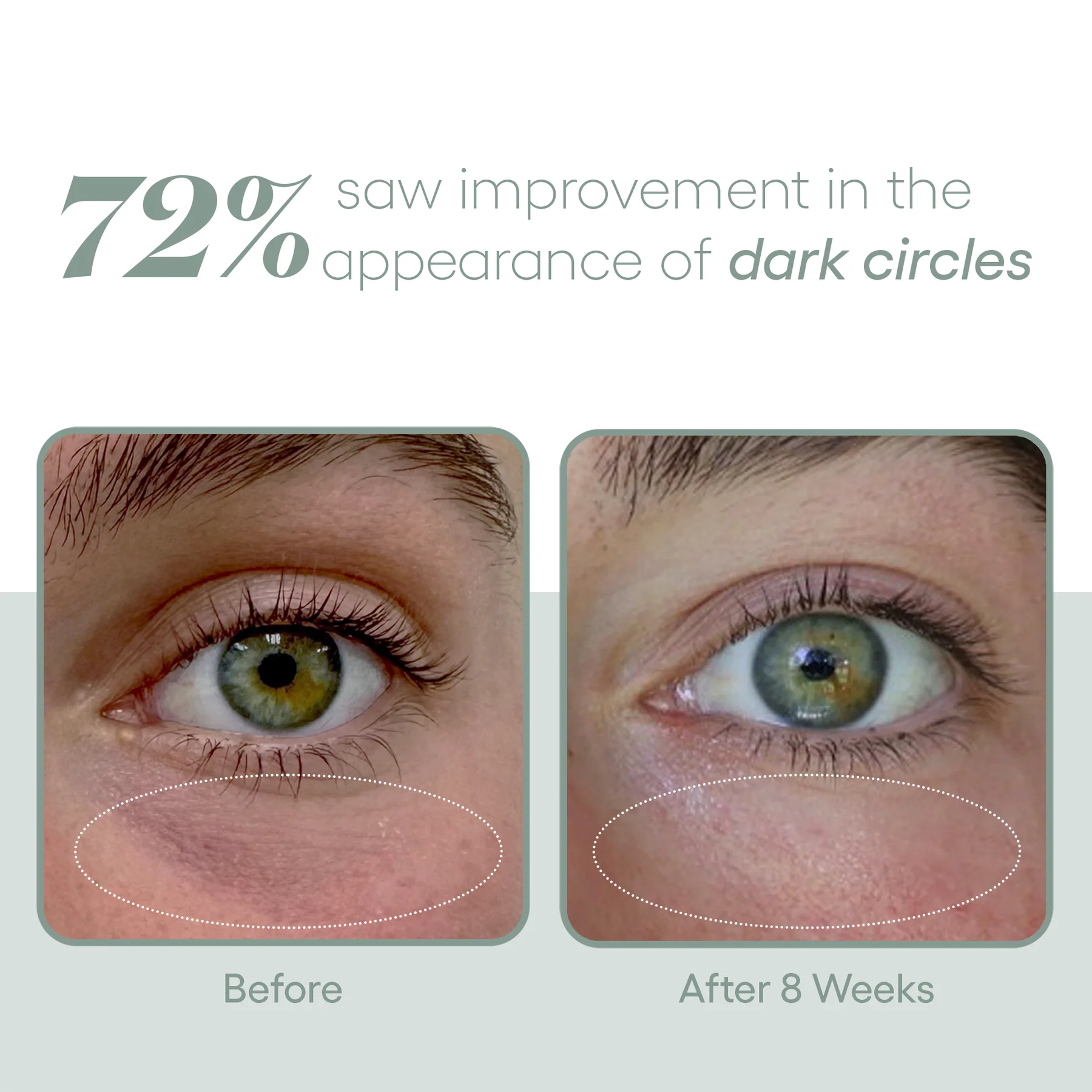EYE Serum - Image 6