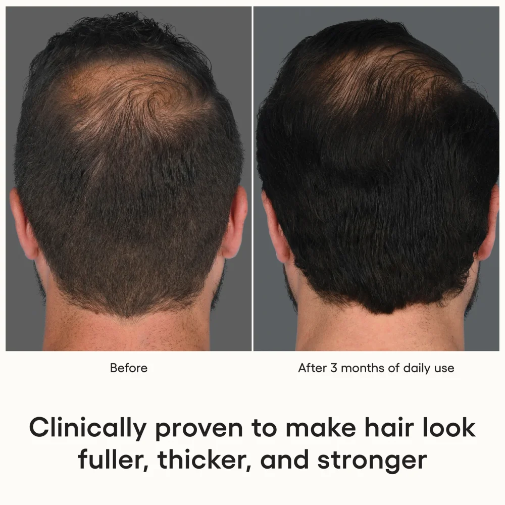 HAIR Serum - Image 6